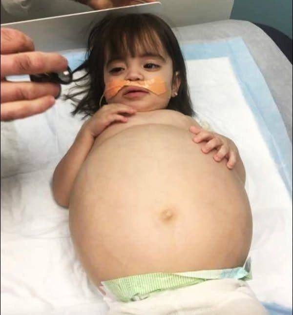 Little girl gets life saving kidney operation thanks to her dad….see more